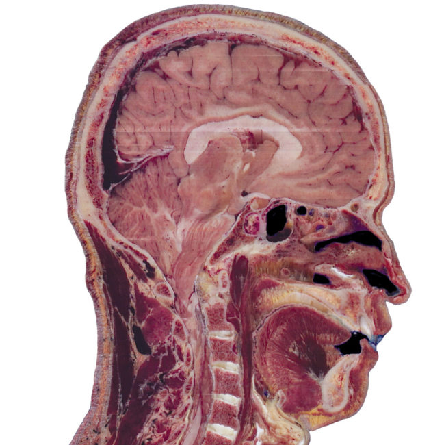 Visuel Table Anatomage