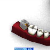 VirTeaSy Dental - Simulateur de Chirurgie Dentaire