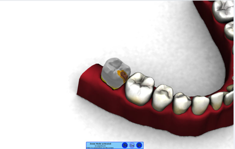 VirTeaSy Dental - Simulateur de Chirurgie Dentaire