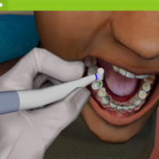 VirTeaSy Dental - Simulateur de chirurgie dentaire